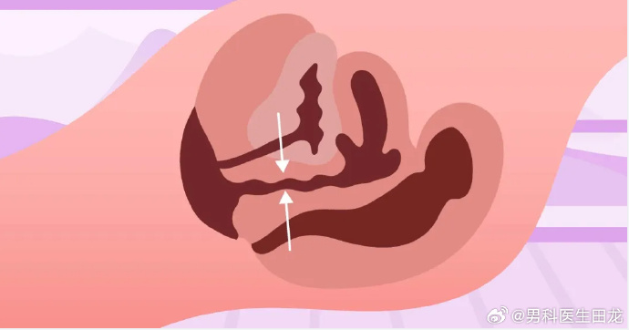 网络色情内容对健康的影响，以男阳茎进女阳道视频为例-第2张图片